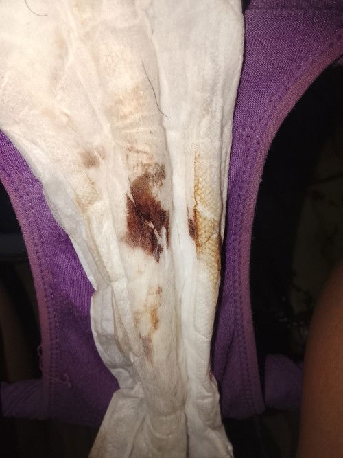 Keluar flek usia 9minggu