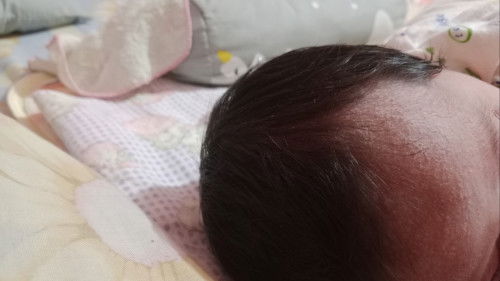 Bund mau nanya obat apa ya untuk new born yang biang keringat seperti di foto?