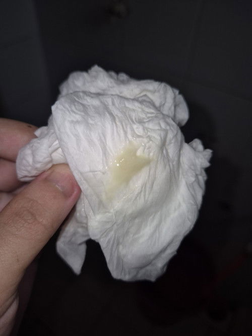 mucus plug