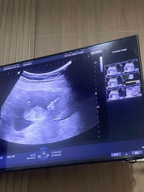 11w6day  วันนี้ไปหาคุณหมอมาค่ะ😍
