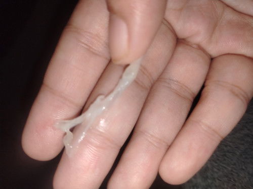 Discharge 25weeks pregnant