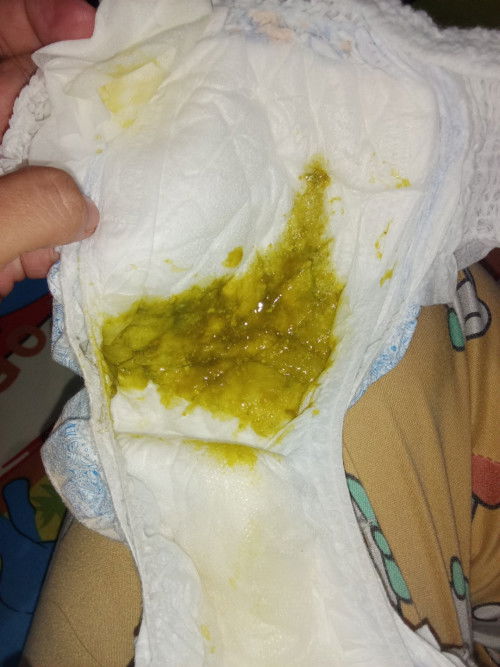 normal lg po ganto poops ni baby breastfeed po 4months si baby kada utot may laman paonti onti lg