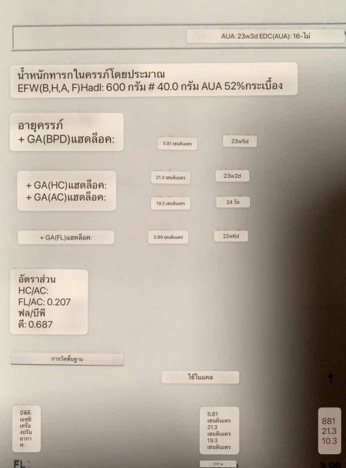 ทารกในครรภ์