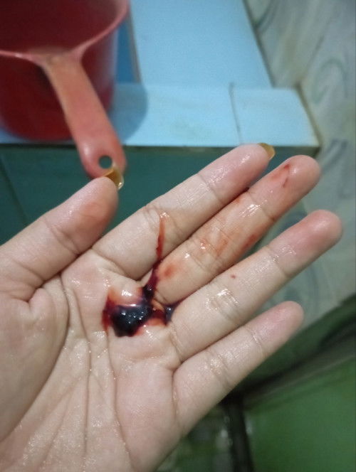 Keluar flek kehamilan 9 minggu