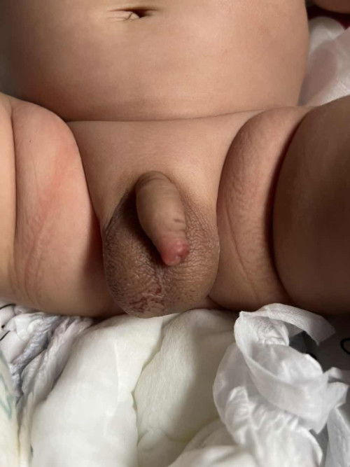 Private part