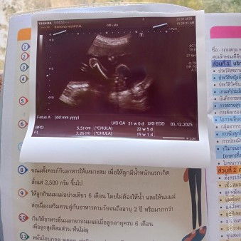 รพ.รัฐอัลตราซาวด์รูปออกมาเป็นแบบไหนบ้างคะ