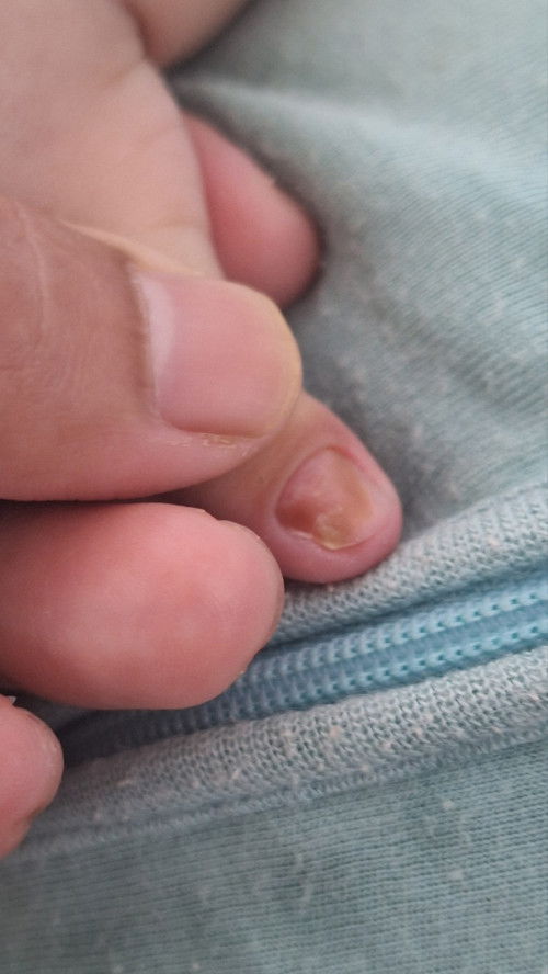 Ada yang pernah bayinya kaya gini??