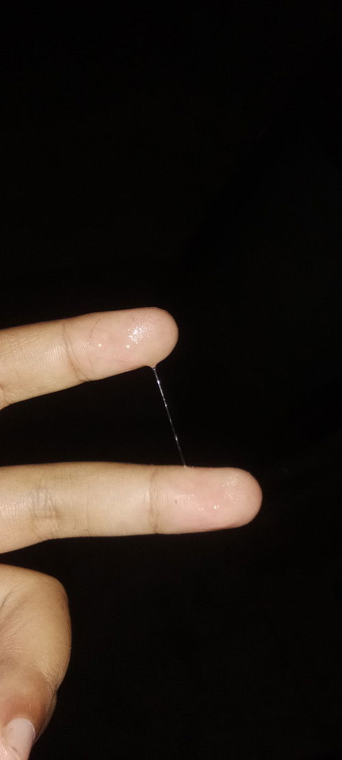 Air ketuban apa bukan