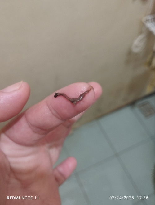 Brown discharge