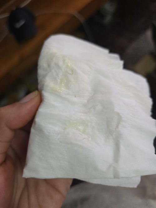 38+1 มีมูกขุ่น เหนียวออกมาแบบนี