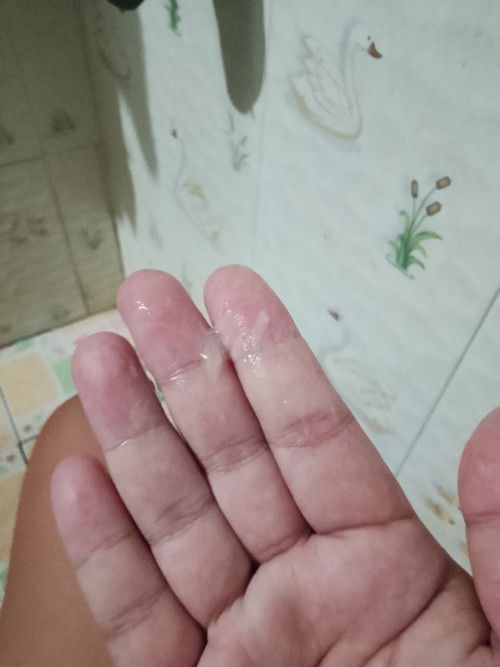 37+3วีค มีมูกไหลออกมาแต่ไม่เยอะ
