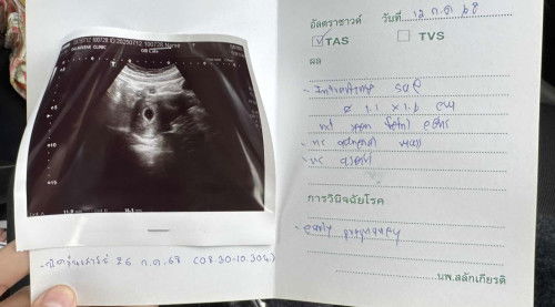 ท้อง6วีค อัลตราซาวแล้วยังไม่เจอน้อง