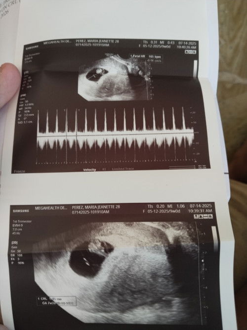 Pregnant 2 montha