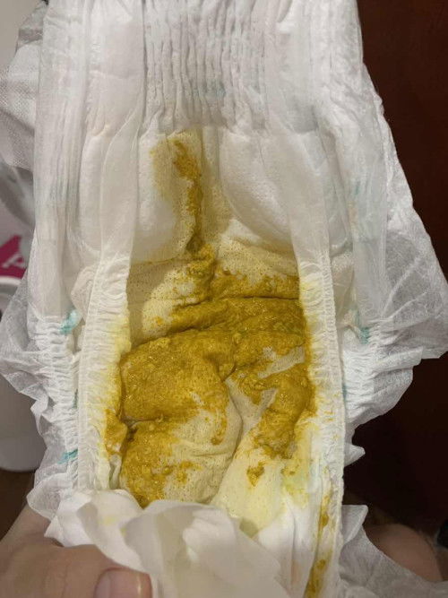 Is this poop normal?