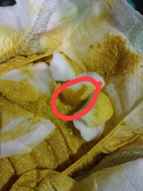 May amoeba ba si baby