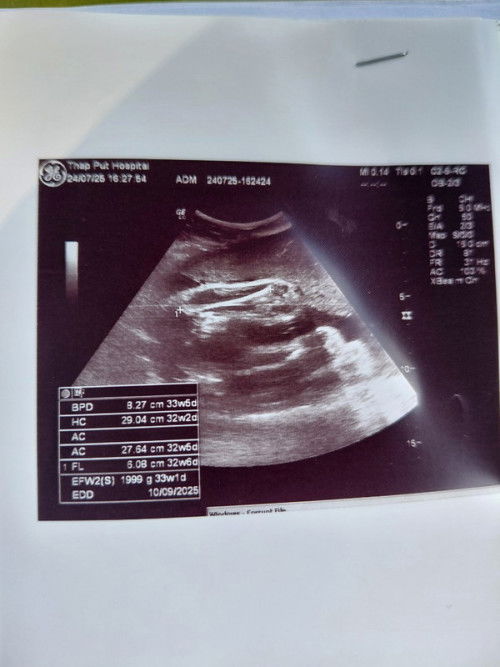 เพศลูก ญ.ช.??