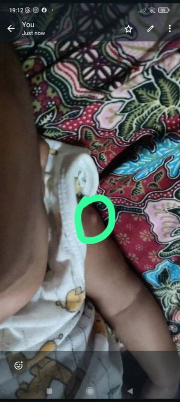 Naik biji kat tempat cucuk