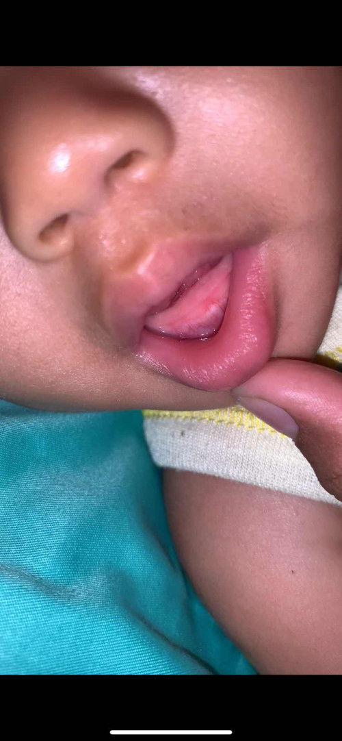 Tumbuh gigi
