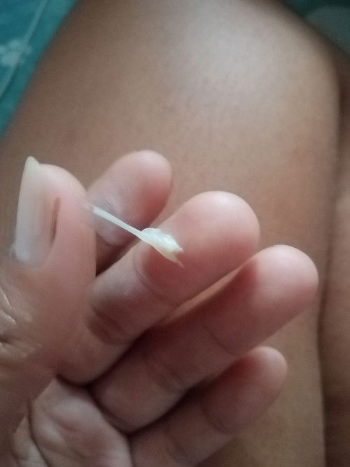 Normal po ba ganito 2 months pregy. Na ako pero d pako ngpapacheck up Kaka pT ko lng kc.