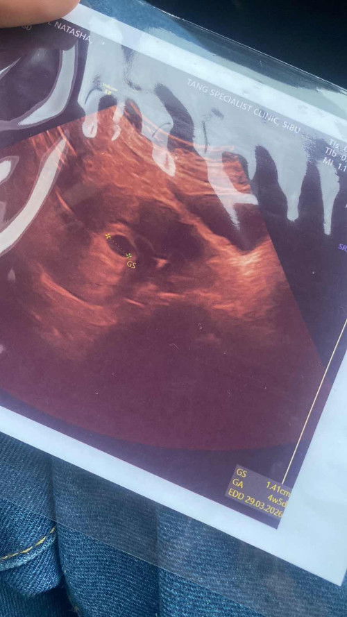 USIA KADUNGAN TAK SAMA DENGAN SCAN