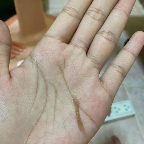 ขออนุญาตสอบถามแม่ๆนะคะ พอดีท้องแรกค่ะ วันนี้นั่งอยู่ดีๆมี มูกสีแบบนี้ออกมาค่ะ เป็นอันตรายไหมคะ อายุครรภ์วันนี้ 32+1 ค่ะ