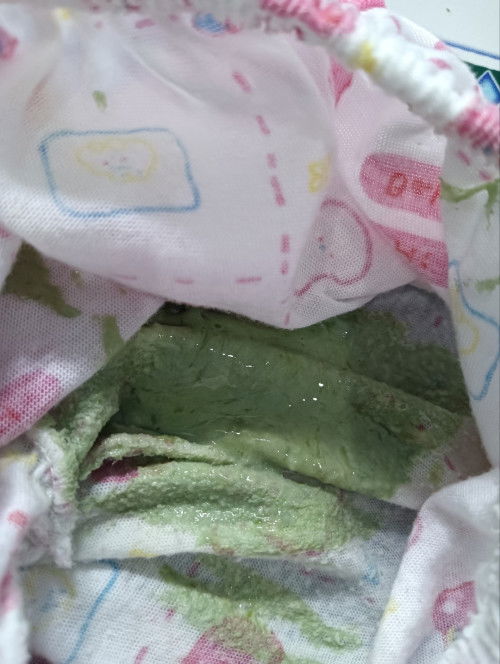 สีอึน้องปกติมั๊ยคะ