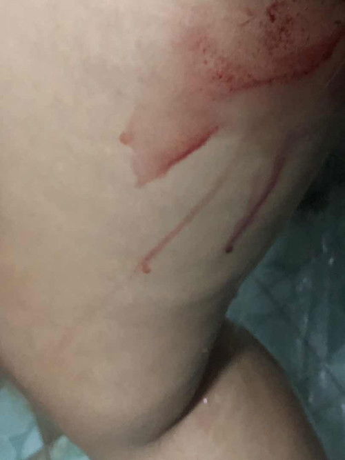 แบบนี้แท้งไหมคะ