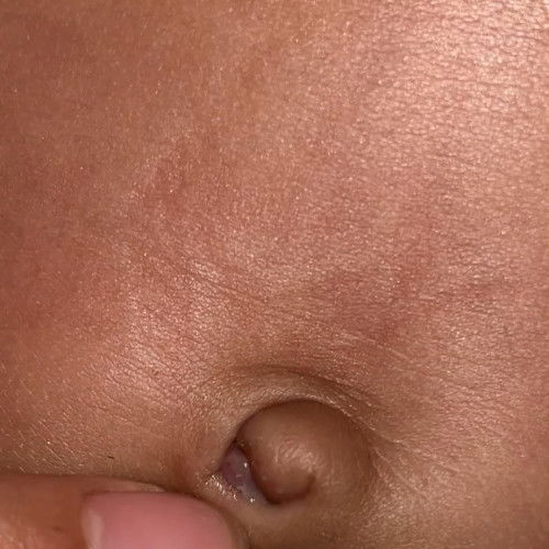 Seperti daging kecil