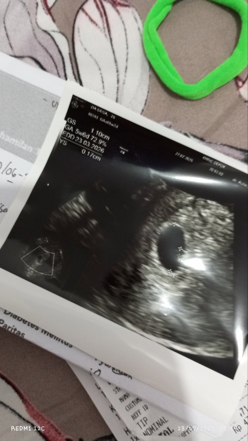 Bunda ada yg sama GK sama aku 5 week baru ada kantung rahim aja ?