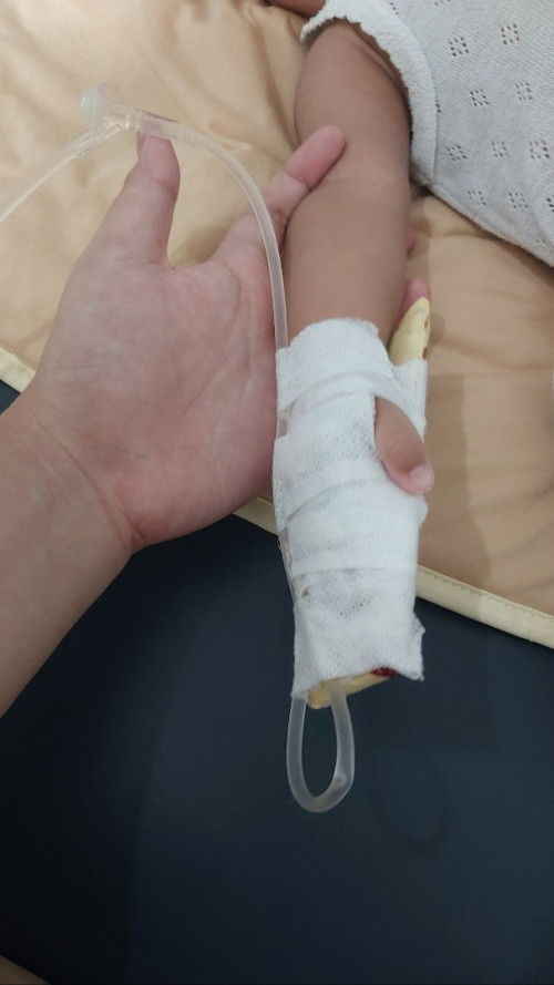 Kejang setelah imunisasi