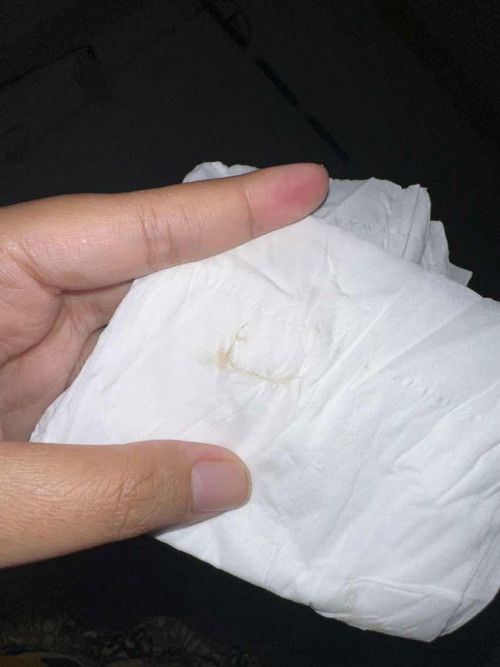 Ini keputihan apa flek
