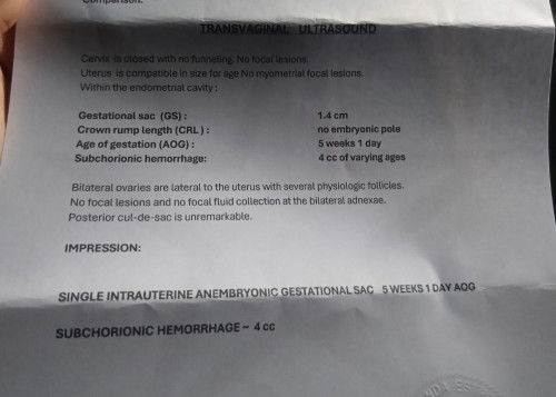 Subchorionic hemorrhage