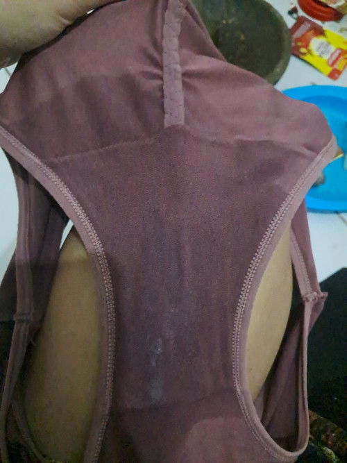 Keluar cairan banyak di 10 week