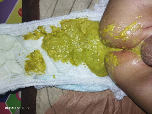 Pup bayi sufor usia 4bln