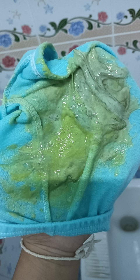 อึสีเขียว