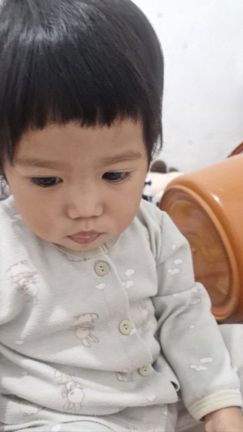 Warna kulit sekitar mulut tidak sama, dengan pipi atau lebih putih di area mulut. Anak usia 17bulan