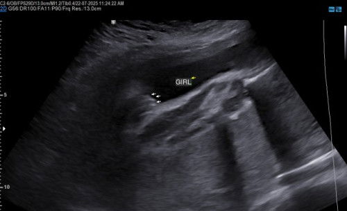 GENDER BABY