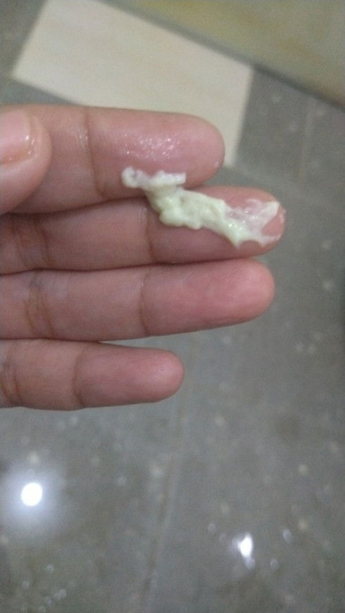 Seputar keputihan, lebih baik kembali berobat ke bidan sebelum nya atau ke obgyn??