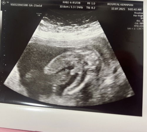 Gender boy or girl?