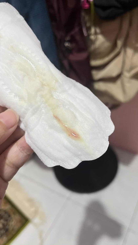 (maaf kirim gambar lendir)