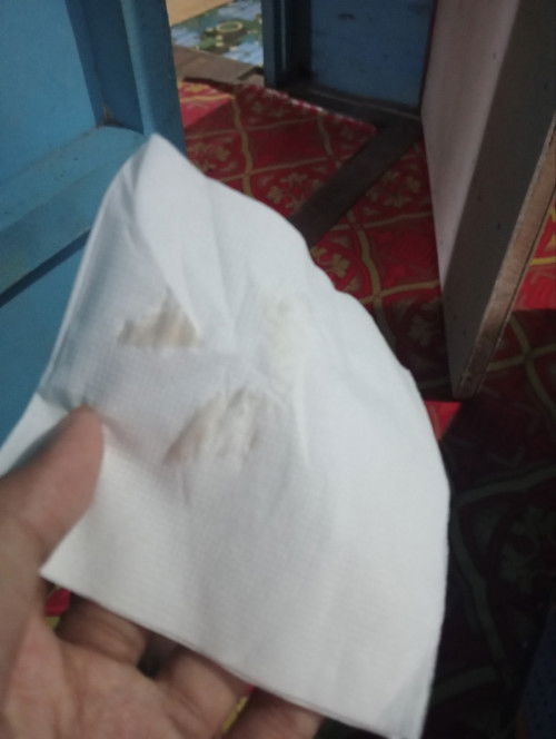 barusan keluar seperti itu kira" bahaya gak ya kehamilan 7 minggu