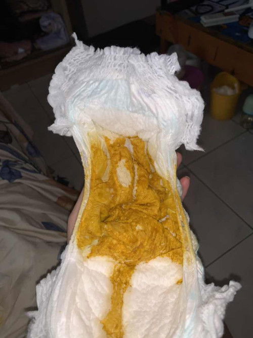 BAB bayi 2 bulan