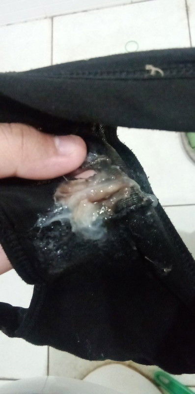 ขอสอบถามแม่ๆคะพอดีเมื่อวานโดนล้วงปากมดลูกไปแต่วันนี้มีมูกแบบนี้แต่ไม่มีอาการเจ็บท้องคะ