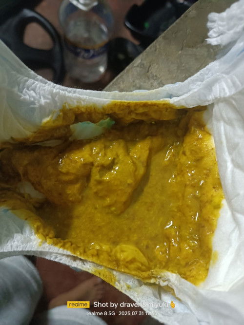 Mga mamsi may naka expirience na po ba sa inyo ng ganito sa lo niyo 😔 pina check ko na siya normal
