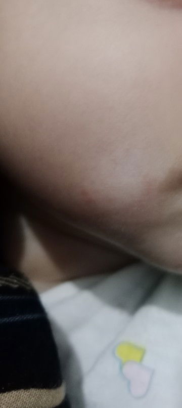Ada yang pernah ngalamin gak bun