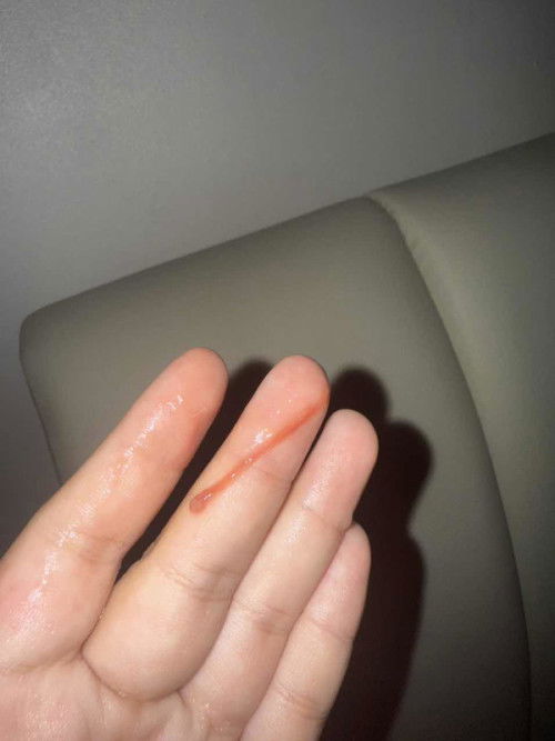 Ada darah di 10 minggu kehamilan
