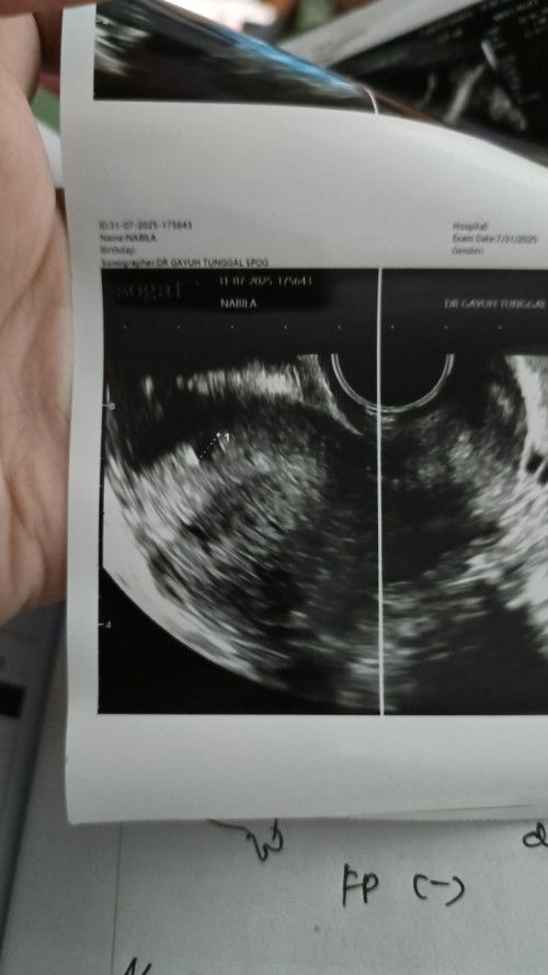 Apakah GS ukuran 0,68 normal?