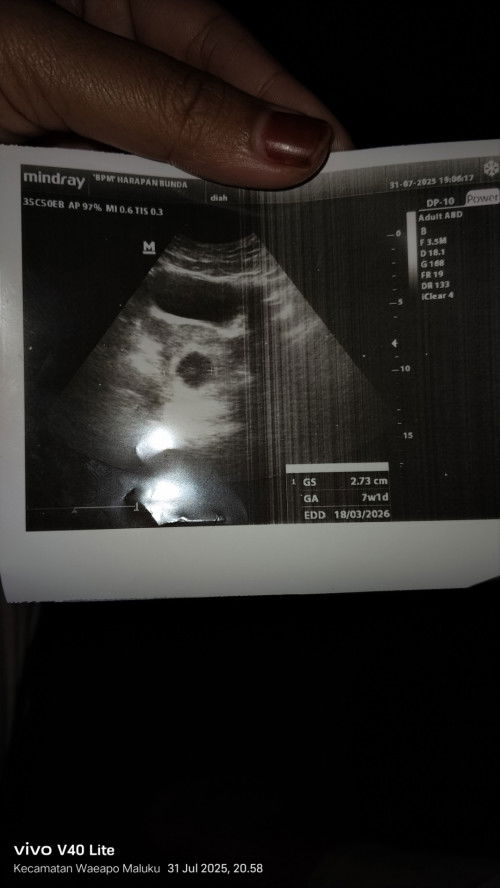 USG 7Mweek tpi di apk 8week