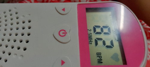 Normal po ba gnitong heartrate?