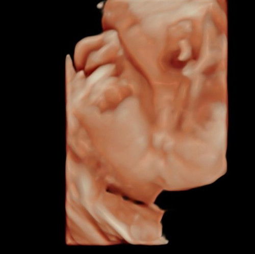 Boy or girl